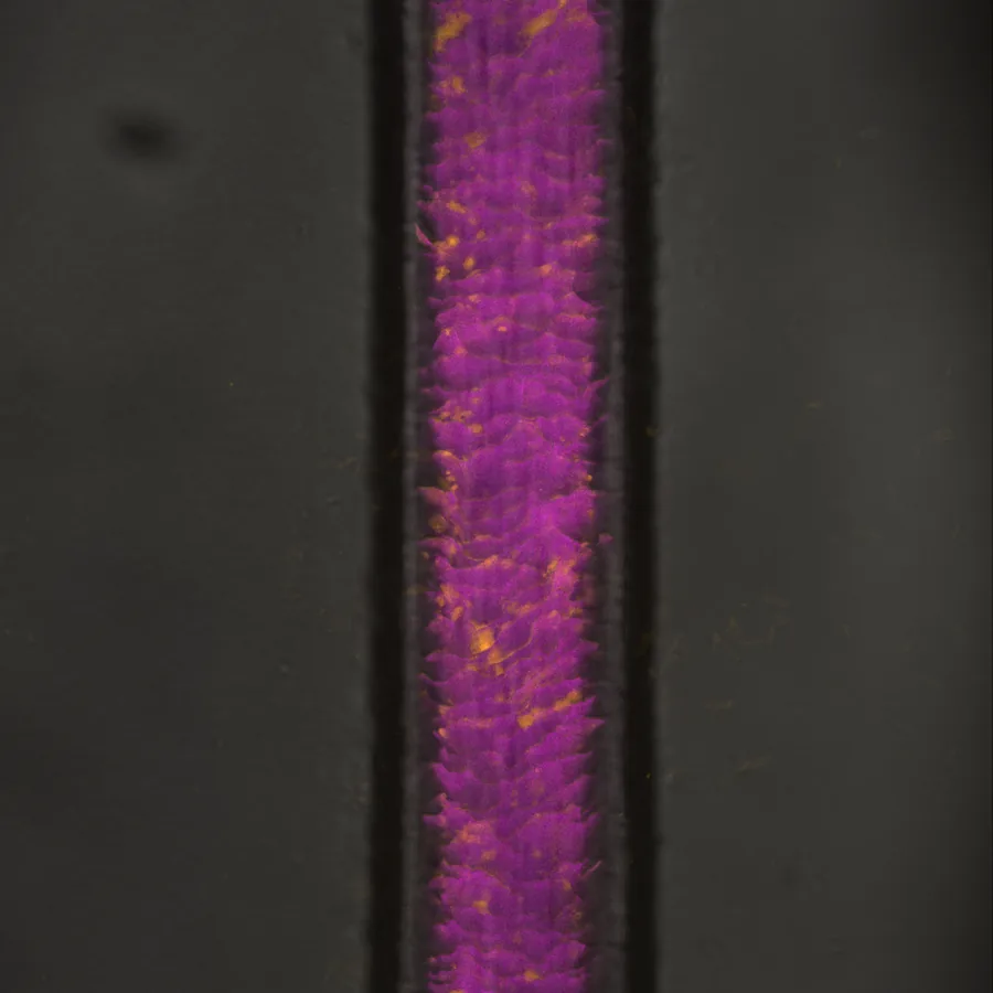 Micrograph of a single human hair shaft