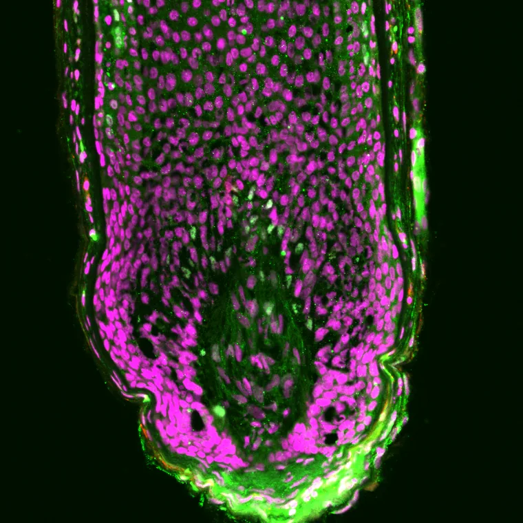 Confocal micrograph of a hair bulb with melanocytes in green