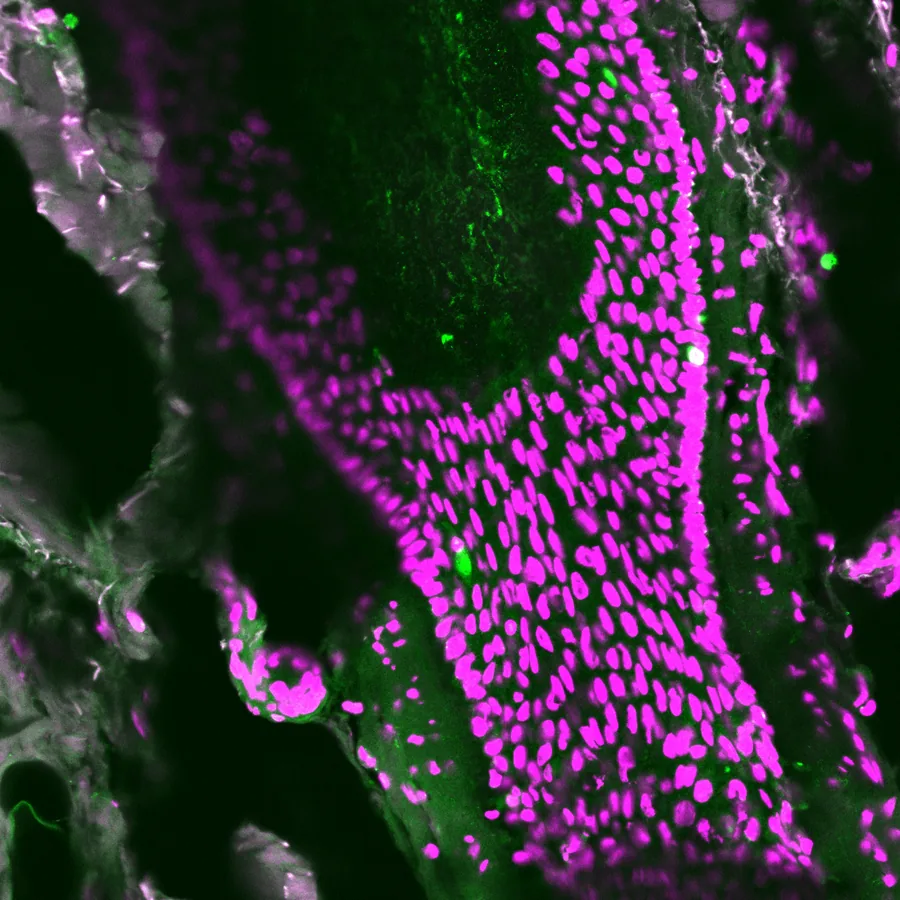 Micrograph deep into a hair follicle showing a melanocyte stem cell