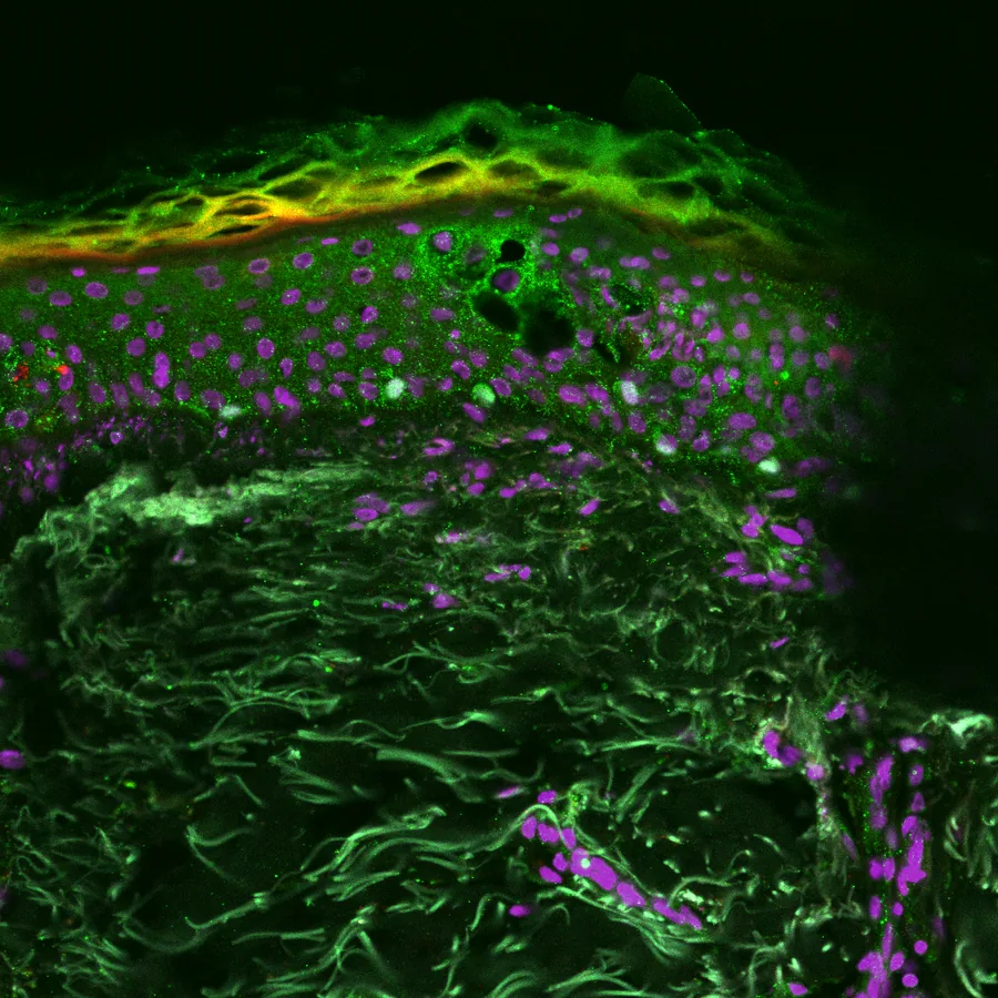 Micrograph of human scalp epidermis